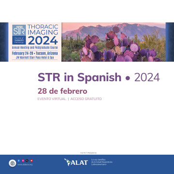 STR in Spanish 2024